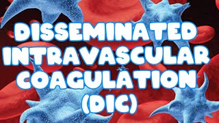 Disseminated intravascular coagulation DIC HEMATOLOGY [upl. by Thalassa]