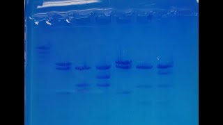 Gel Electrophoresis Forensic DNA Analysis [upl. by Akiemaj]