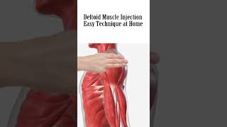 How to give an intramuscular IM Injection in deltoid muscle in shoulder easily at home [upl. by Lugo]