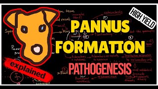 Rheumatology Mechanism of Pannus formation in Rheumatoid Arthritis [upl. by Nylecaj446]