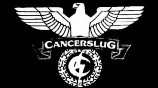 Cancerslug  Archangel amp All Murder All Guts All Fun [upl. by Konikow]