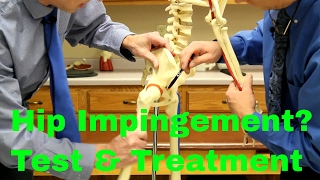 Hip Impingement Causes Treatment amp Test for Femoral Acetabular Syndrome [upl. by Pauwles]