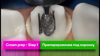 Crown prep  Step 1  Препарирование под коронку [upl. by Margaux]