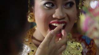 balinese tradition Potong GigiMapandes tooth filing [upl. by Cornel524]