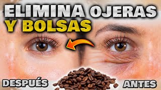 ¿Cómo quitarse las bolsas de los ojos sin cirugía Ejercicios faciales YouTube [upl. by Teague]