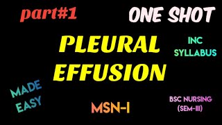 Pleural effusion  MSN1 [upl. by Hameerak417]