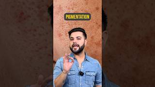 Dark Spots amp Pigmentation Treatment 3 Super Food’s for Clear amp Glowing Skin [upl. by Kenway384]