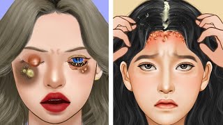 ASMR Remove unmanaged piercing pus animation  Squeeze nose acne The girl with lot of nose piercing [upl. by Whitnell585]