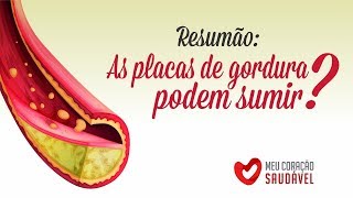 As quotplacas de gorduraquot aterosclerose podem sumir Um Resumão [upl. by Acihsay]