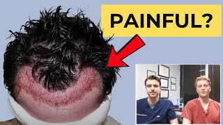 How Painful is a Hair Transplant [upl. by Omoj22]