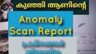 Detailed Anomaly Scan20 Week Scanning ReportSecond Trimester Scanning Report [upl. by Divaj]