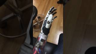 First Dynamic Fitting of My New Bionic Hand [upl. by Anaxor]