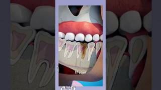 tooth infection preventing tooth infections youtubeshorts dentist [upl. by Notreve855]