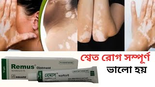 শ্বেত রোগ ভালো করার মলম  Remus Ointment  Tacrolimus 01 [upl. by Leffert371]