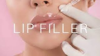 Lip Fillers Explained  Benefits Procedure Cost amp Side Effects [upl. by Byrdie]