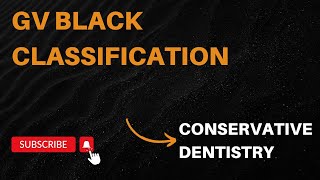 GV Black classification of tooth preparation  conservative dentistry  imp [upl. by Oiramej]