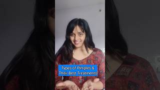 Types of Pimples amp Their Best Treatment health skincare acne awareness [upl. by Ainekahs530]