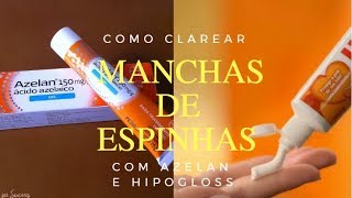 COMO CLAREAR MANCHAS DE ESPINHAS COM AZELAN E HIPOGLOS  QUASE PRONTA [upl. by Silvia]