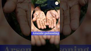 Arsenic poisoning in UP posion harmful up [upl. by Sitra694]