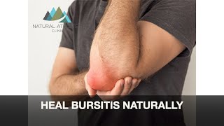 Heal Bursitis Naturally [upl. by Yenitirb]