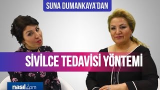 Sivilce nasıl geçer Suna Dumankayanın önerisi  Sağlık  Nasilcom [upl. by Nnyllatsyrc143]