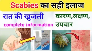 Scabies का पूरा इलाज Scabies की सबसे अच्छी दवा  Scabies treatment in hindi permethrin lotion [upl. by Mohl]