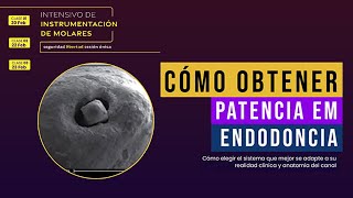 Cómo Obtener patencia em Endodoncia [upl. by Hymie]