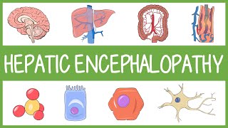 Understanding Hepatic Encephalopathy with Mnemonics [upl. by Ahsrats265]