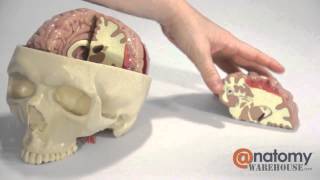 Diseased Brain In Skull Anatomy Model by AnatomyWarehousecom [upl. by Ecyob]