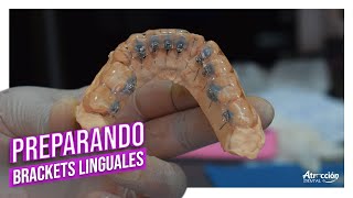 Como preparar la colocación de brackets linguales [upl. by Marlee426]