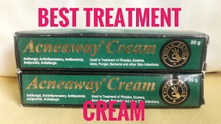 Acneaway Cream ReviewBest Treatment Cream For Fungi Fungal Treatment [upl. by Ube]