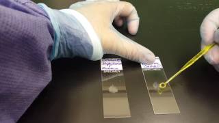 Microbiology the Catalase test [upl. by Hocker410]