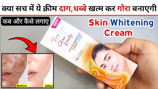 Glow And Lovely Ayurvedic Cream Review  fair and lovely ayurvedic cream  fair lovely cream [upl. by Sonaj]