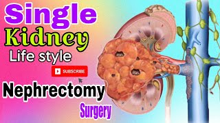 Nephrectomy Surgery  Single Kidney Life Style  Dr N R Daruka Urologist [upl. by Srini]