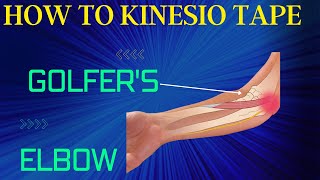 How to treat Golfers Elbow  Ulnar Nerve using Kinesiology Tape [upl. by Lance]