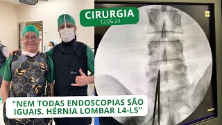 Nem todas Endoscopias são iguais Hérnia Lombar L4L5  120624 [upl. by Junno]