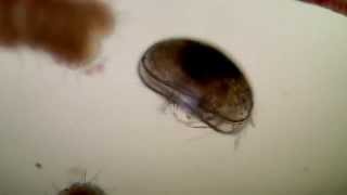 č˛ťĺ˝˘č™«ă®1ç¨® Ostracoda sp [upl. by Rudie]