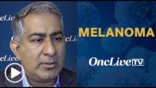 Dr Khushalani on FixedDose Treatment Regimens in Advanced Melanoma [upl. by Ahsiuqel787]