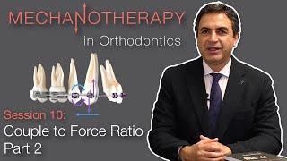 Mechanotherapy in Orthodontics Couple to Force Ratio Pt 2 [upl. by Lahpos]