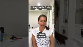 Herpes Cure 2017  Breakthrough Herpes Cure Found  Massive News For Herpes Patients [upl. by Ku]