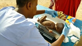 Cruz Roja en Somalia hay más de 350 mil niños desnutridos [upl. by Anitnamaid]