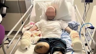 Drugs gang send a brutal message cutting off man’s leg fingers and partners fingers [upl. by Aecila856]