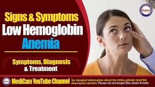 Low Hemoglobin Symptoms Causes And Treatment Medicam [upl. by Eilrahs]