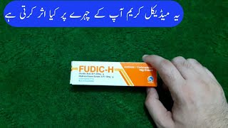 Fudic H Cream Used For Acne Burn And Skin allergy  Hindi urdu [upl. by Theo]