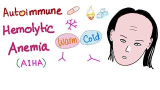 Autoimmune Hemolytic Anemia AIHA  Warm autoantibodies IgG  Hematology [upl. by Sullivan249]