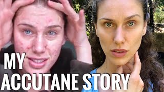 My Accutane Story My Acne Meds  Why I Never Took IsotretinoinAccutane [upl. by Ereveneug855]