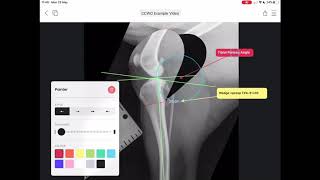 How to plan a CCWO Cranial Closing Wedge Ostectomy in vPOP Pro [upl. by Isac]