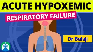 Type 1 Respiratory Failure Causes amp Mechanism Dr Balaji vasu [upl. by Aisetal]