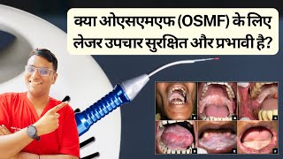 Dr Rudra Mohan  क्या ओएसएमएफ के लिए लेजर उपचार सुरक्षित और प्रभावी है LASER OSMF TREATMENT [upl. by Erasme]