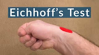 Eichhoff’s Test for De Quervain’s Tenosynovitis  The Finkelstein’s Test that you do Yourself [upl. by Aramad]